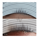 Lash rehab after chemo therapy