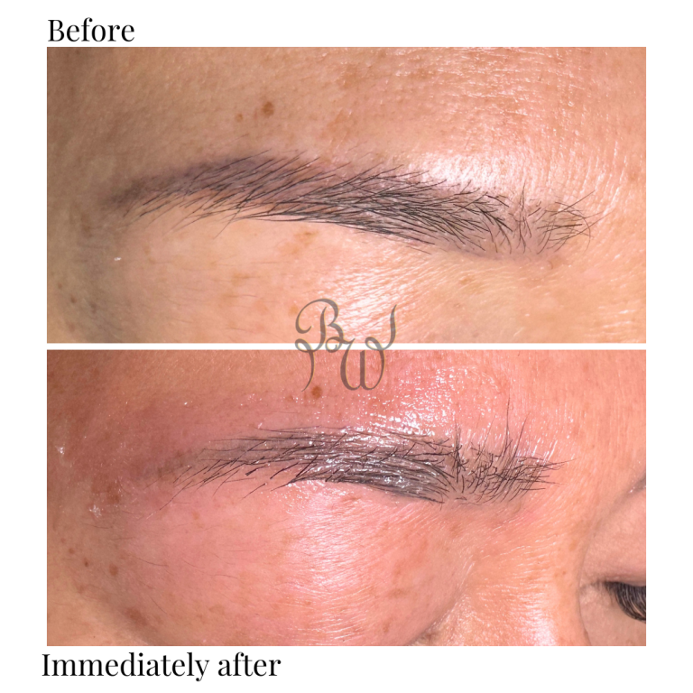 LM brows L
