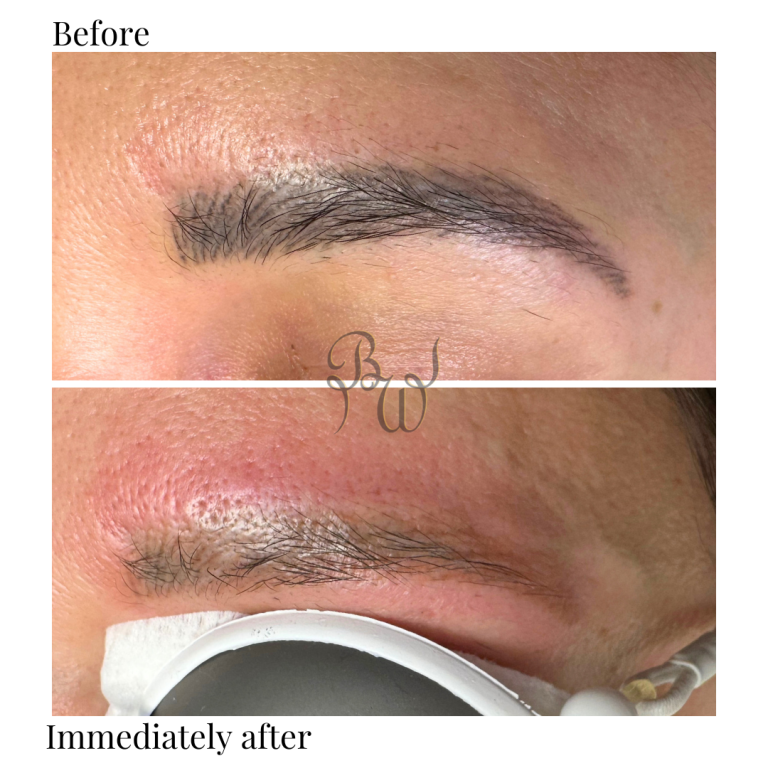 MW brows