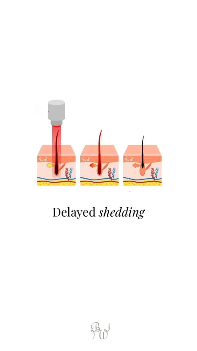 Instagram post from bushwhackedyeg. This post is in position 2.